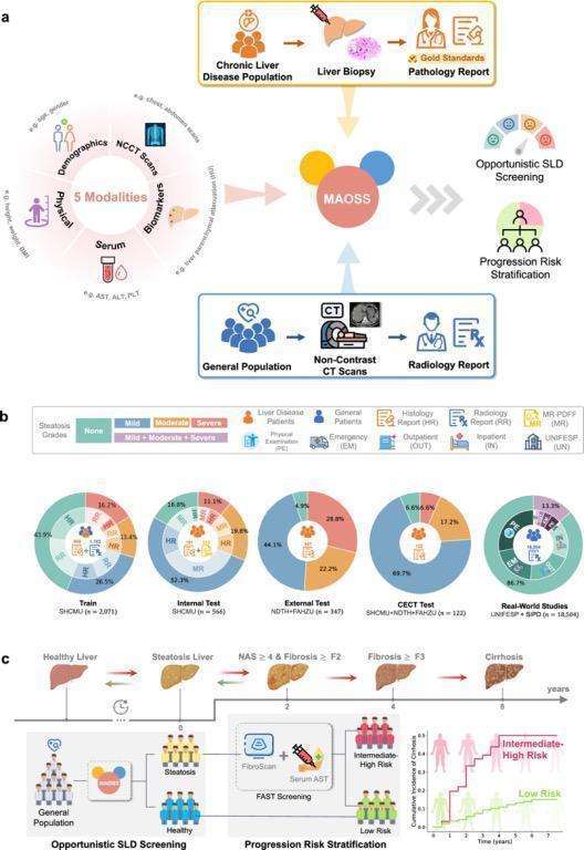  达摩院推出MAOSS模型，脂肪肝筛查迎来新突破；高风险识别能力显著增强。 IT技术